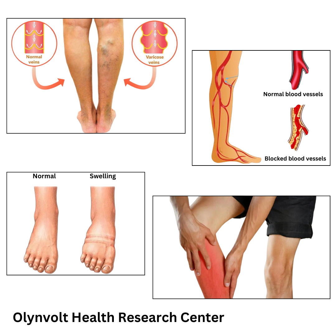 Leg Health Guardian: Olynvolt AirPower Boots Pro š