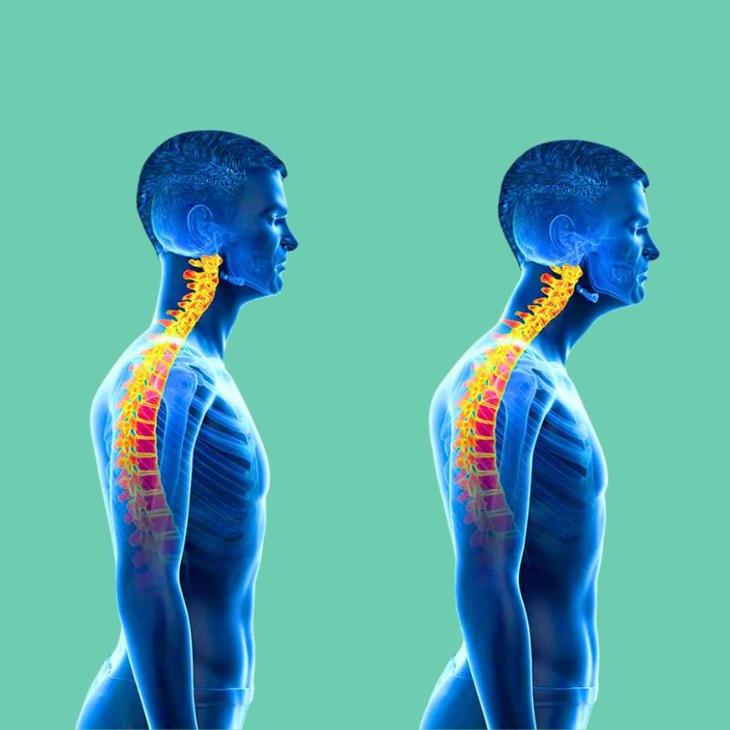 🔍Protect Your Neck: Exploring the Risks of Forward Neck Posture